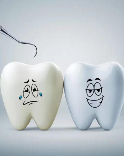 Teeth work-08