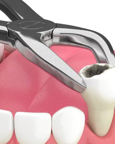 Teeth work-19