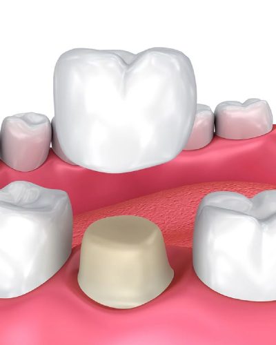 Teeth work-26